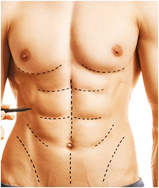 360 Liposuction