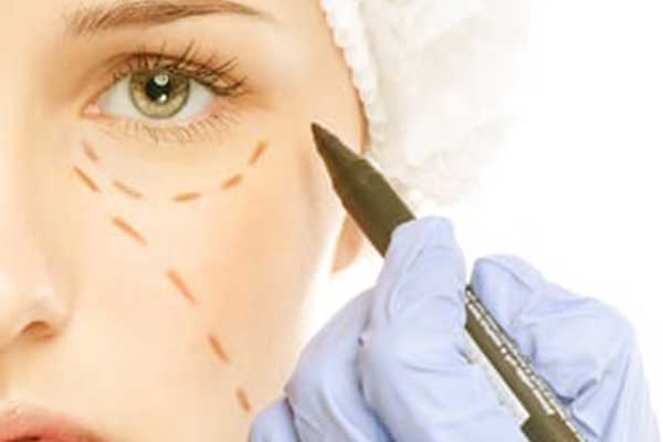 Lower Blepharoplasty