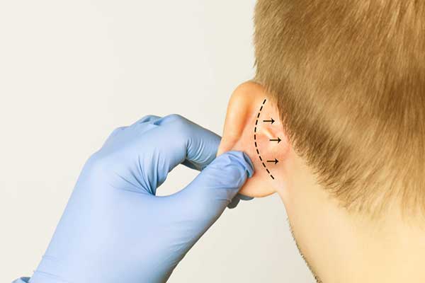 Ear Surgery